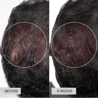 Red Light Therapy Cap for Hair Regrowth