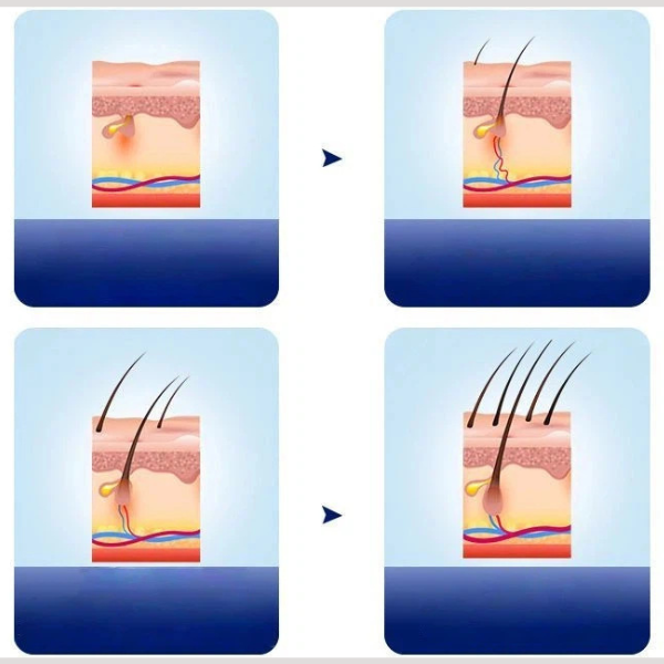 Red Light Therapy Cap for Hair Regrowth