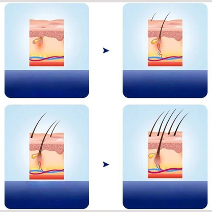 Red Light Therapy Cap for Hair Regrowth