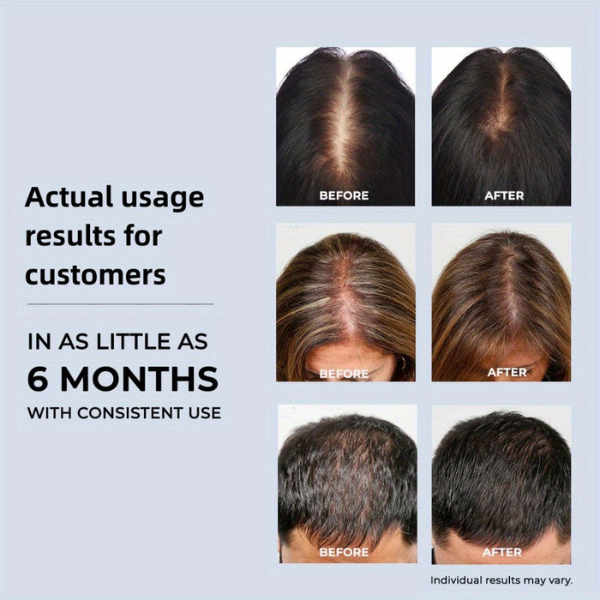 Red Light Therapy Cap for Hair Regrowth