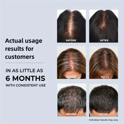 Red Light Therapy Cap for Hair Regrowth